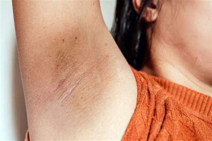 armpit zit